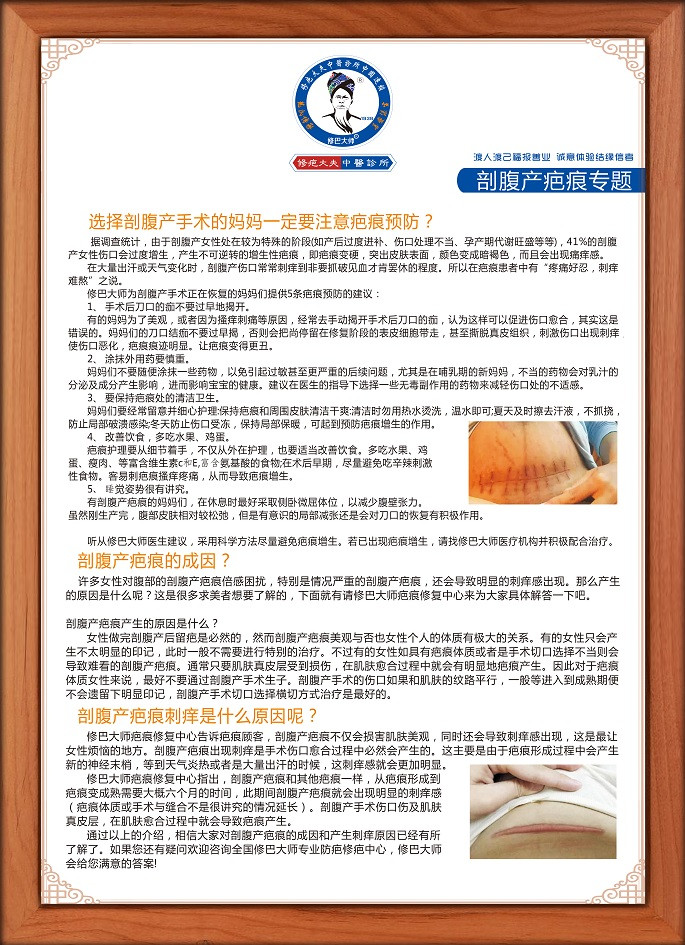 修巴大师-剖腹产疤痕专题15.jpg